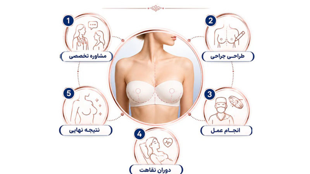 با نحوه عمل جراحی ماموپلاستی آشنا شوید