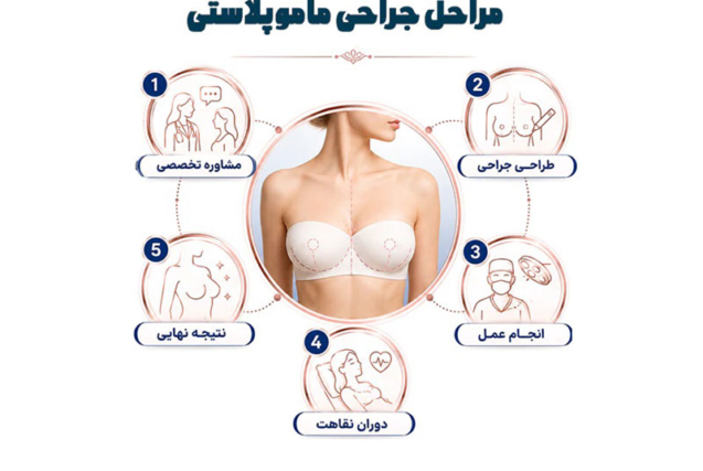با نحوه عمل جراحی ماموپلاستی آشنا شوید